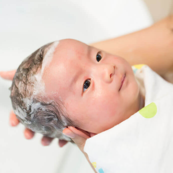 Cradle cap treatment store uk